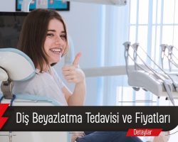 Diş Beyazlatma Tedavisi Ve Fiyatları